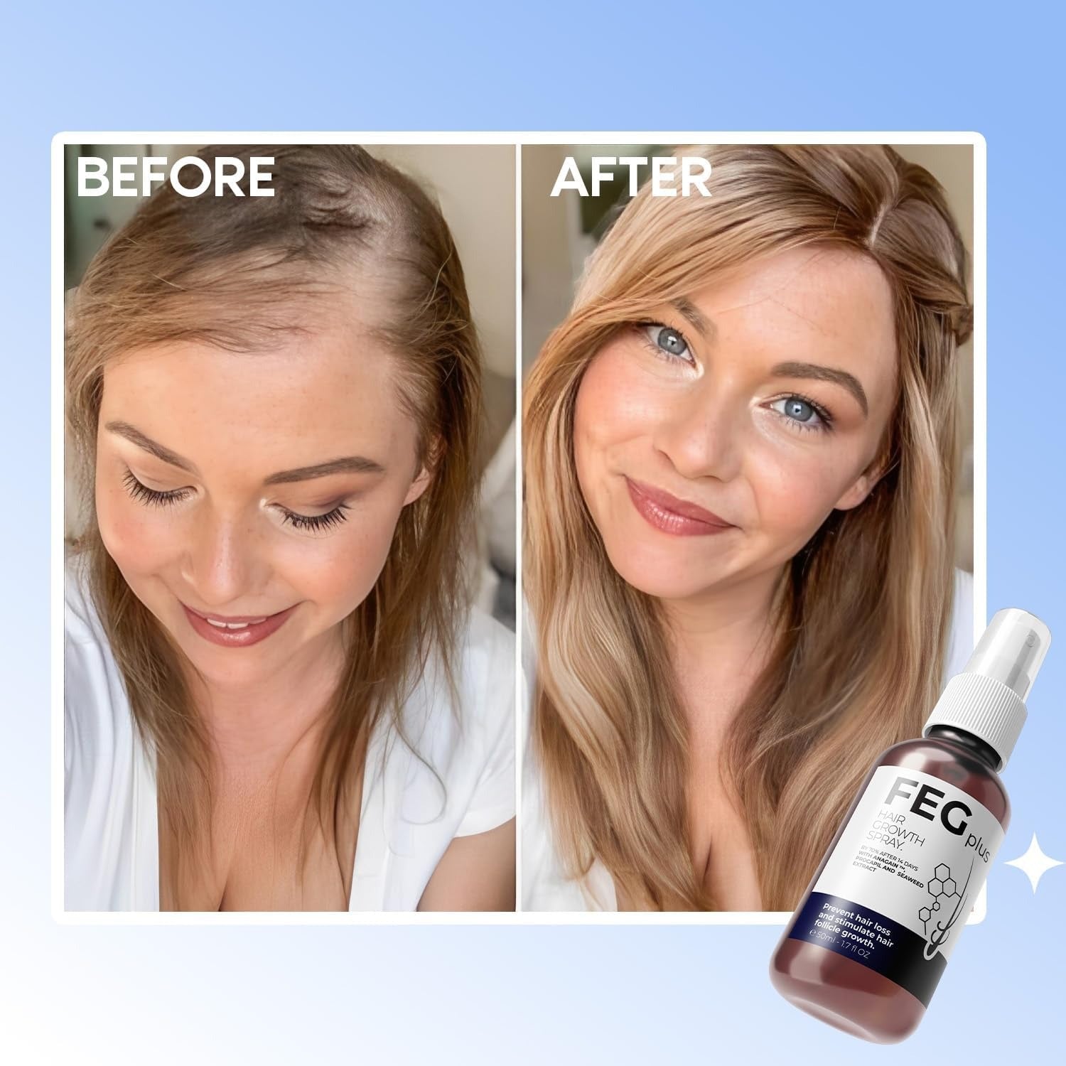 FEG Plus Hair Growth Stimulator Spray – Natural Formula with Anagain, Rosemary & Camellia (50ml)